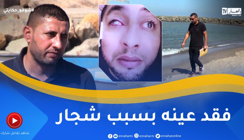 شوفو حكايتي: بعد شجار عنيف شاب يفقد عينه اليسرى.. “معرفتش حتى لقيتو ضربني بمفتاح للعين”
