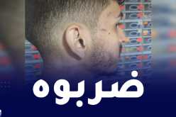 بالصور.. طالب سابق بجامعة البليدة 2 يتعرض للضرب عن طرف أعوان الأمن