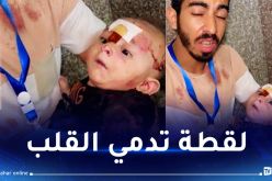 فيديو جد مؤثر.. طفل فلسطيني مصاب ومخضب بالدماء لم يتم التعرف على عائلته