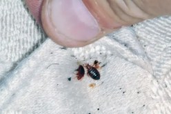 علاجات منزلية لقرصة “البق” وكيفية التخلص منه بالطرق الطبيعية