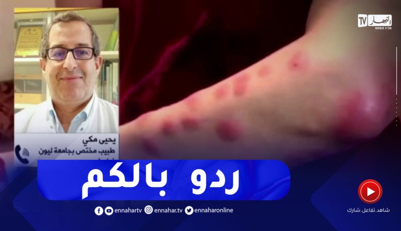 طولها 7 مم و مشاكلها أكبر من حجمها..هذامايجب معرفته عن بق الفراش