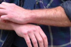 لهذا السبب نشعر بالرغبة في الحكة عند التحدث عن “البق” و”القمل”