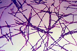 بعد ذوبان الجليد بالقطب الشمالي.. مخاوف من استيقاظ فيروس “الزومبي”