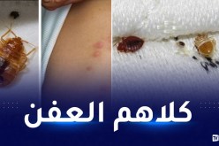 القذارة تأكل فرنسا.. حقائق صادمة تقف عليها “النهار أونلاين” حول حشرة البق