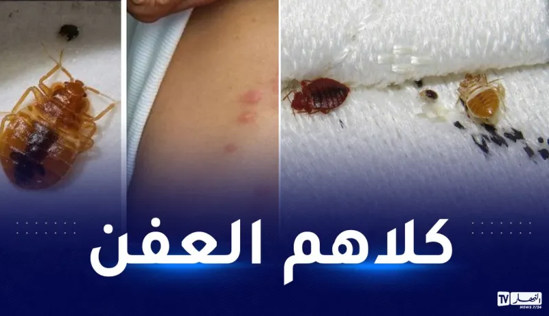 القذارة تأكل فرنسا.. حقائق صادمة تقف عليها “النهار أونلاين” حول حشرة البق