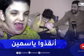 مجتمع: مرض نادر ينخر جسم ياسمين وأملها الوحيد العلاج بالخارج