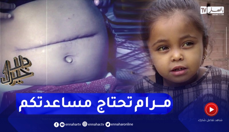 دلال خير: تشمع الكبد .. مرض خبيث ينهش جسد الطفلة مرام