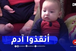 تلمسان / عائلة الرضيع آدم تناشد المحسنين لإنقاذ قدمه من البتر