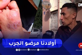 موطنون في حمر العين :” أولادنا كلاهم الجرب رانا نسوفريو !!”