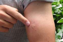 لمناصري الخضر.. هذا ما يجب معرفته عن الملاريا !