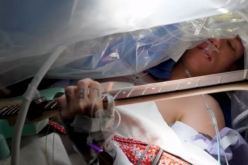 موسيقي يعزف على الجيتار أثناء عملية جراحة الدماغ