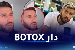 فيصل المينيون يثير الجدل بخضوعه للتجميل!