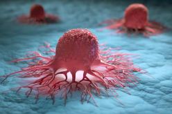 الصحة العالمية تتوقع ارتفاع حالات السرطان بنسبة 77% في 2050