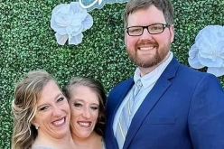 زواج التوأم الملتصق الشهير آبي وبريتاني