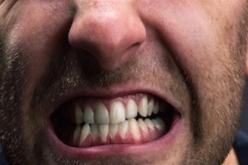 هكذا يُؤثر التوتر على صحة الأسنان