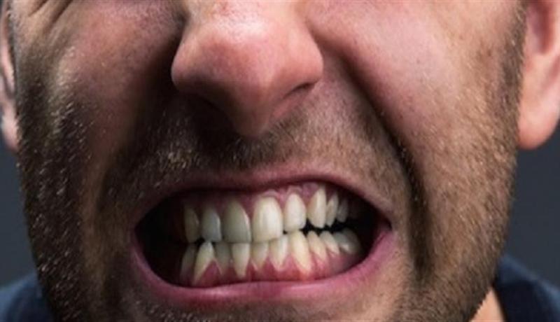هكذا يُؤثر التوتر على صحة الأسنان