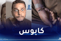 صدمة.. حالة مُرعبة لأسير أفرج عنه الإحتلال الصهيوني