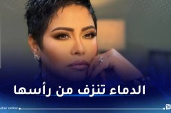 صورة صادمة لشيرين بعد إعتداء حسام حبيب عليها!