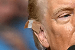 طبيب يكشف حالة ترامب عقب محاولة إغتياله