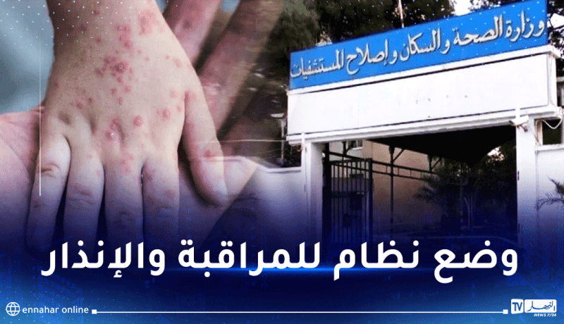 وزارة الصحة تصدر بيانا هاما حول مرض جدري القردة