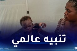 بيان هام من الصحة العالمية حول “جدري القرود”