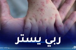 أرقام مرعبة عن انتشار جدري القردة