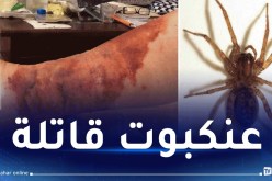 متواجدة بالجزائر ودول المتوسط.. عنكبوت تتسبب في وفاة شخصين بإيطاليا
