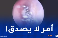 عنكبوت ينسج شبكة داخل أذن إمرأة!