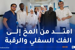 بالتفاصيل.. أطباء مستشفى وهران ينجحون في استئصال ورم ضخم