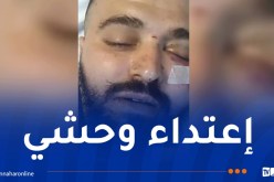 اعتداء عنيف من أحد موظفي شركة كورسيكا على مسافر جزائري 