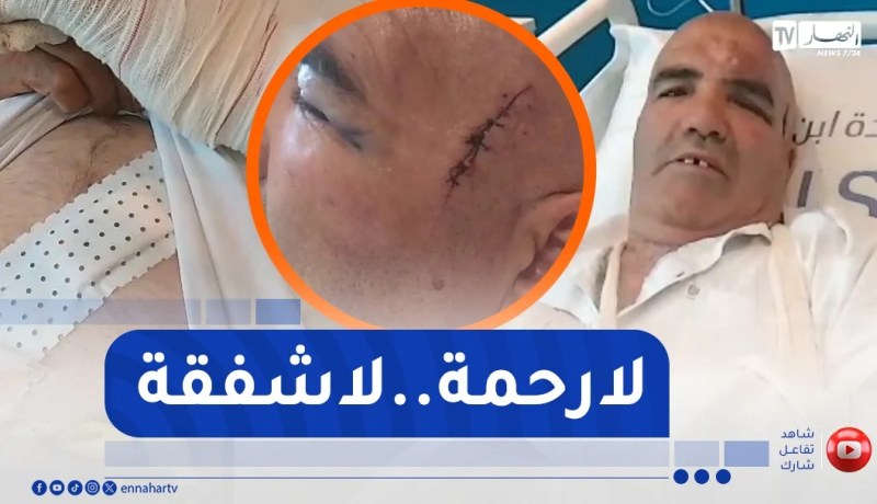شاهد..حالة “عمي موسى” المواطن الذي تعرض للسرقة و الضرب بعين فكرون