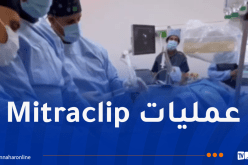 إنجاز طبي غير مسبوق في مستشفى وهران