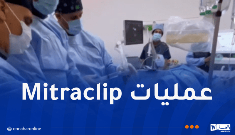 إنجاز طبي غير مسبوق في مستشفى وهران