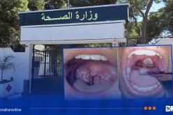 سكيكدة.. وفاة شخصين وتسجيل 5 حالات مؤكدة بداء الدفتيريا