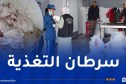 حجز أكثر من 900 كلغ لحوم بيضاء فاسدة بالبليدة