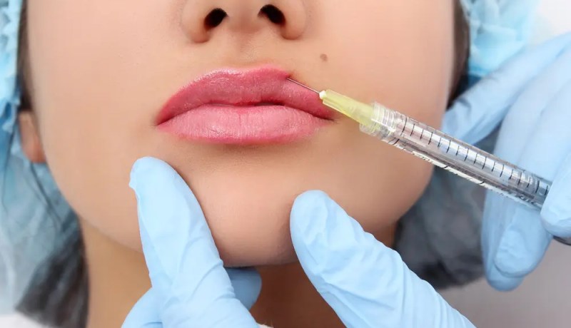 حقنة فيلر تحدث مضاعفات خطيرة بوجه فتاة وتورّط طبيبة عامّة ومساعدتها قضائيا