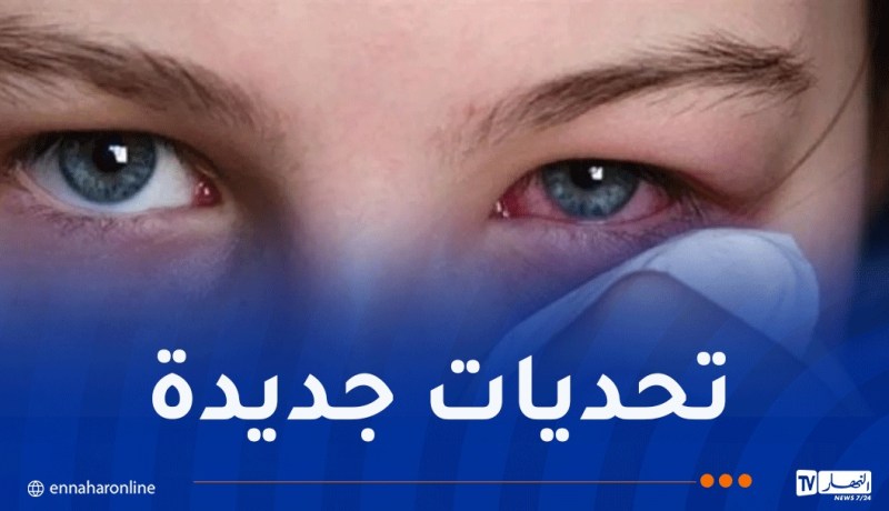 منظمة الصحة العالمية تؤكد أن الجزائر نجحت في القضاء على “الرمد الحبيبي”