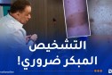 أطباء يحذّرون.. هذه أعراض الورم الليفي العصبي من النوع الأول (NF1)