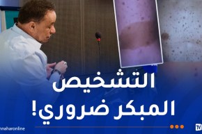 أطباء يحذّرون.. هذه أعراض الورم الليفي العصبي من النوع الأول (NF1)