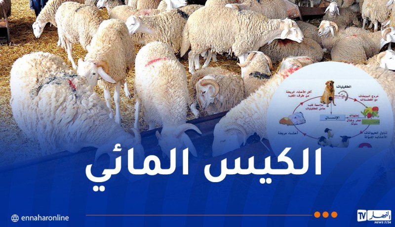 الكيس المائي: حملة للوقاية ومكافحة الداء