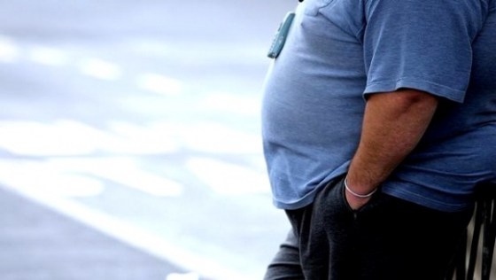 Surpoids et obésité réduisent l’espérance de vie de 1 à 10 ans