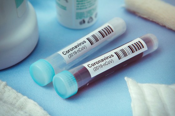 Coronavirus : 116 nouveaux cas confirmés et 3 nouveaux décès en Algérie